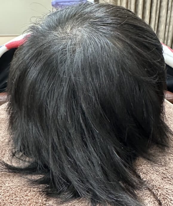 治療後