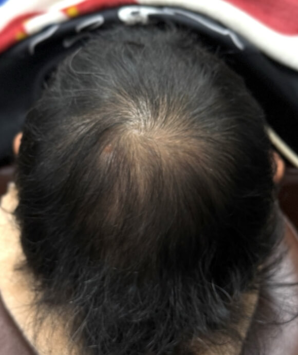 1年後