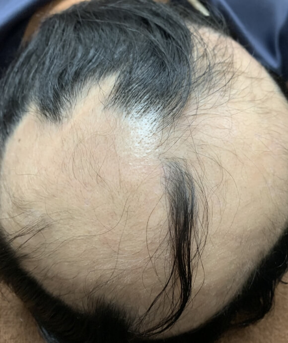 治療前