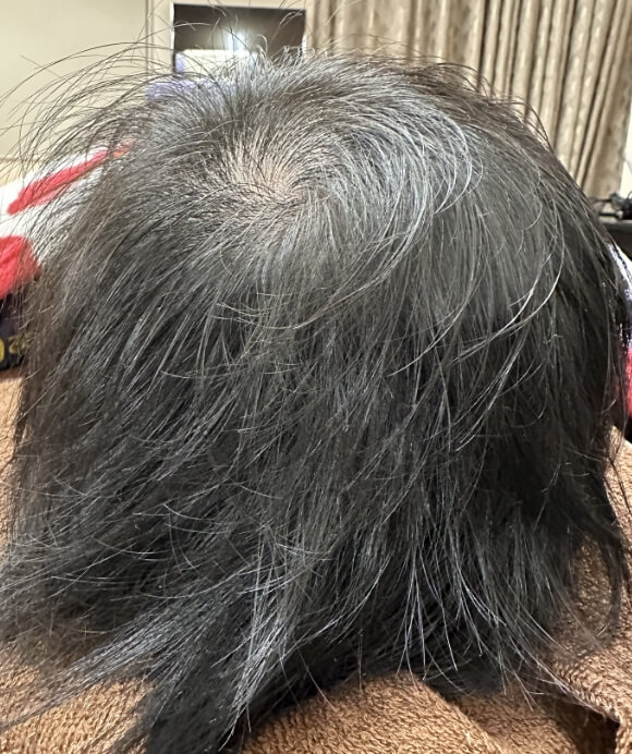 1年7ヶ月後