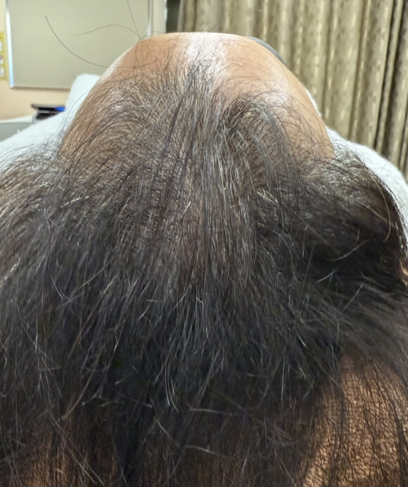 1年後