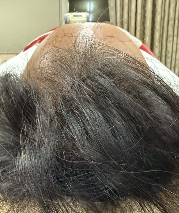 1年1ヶ月後