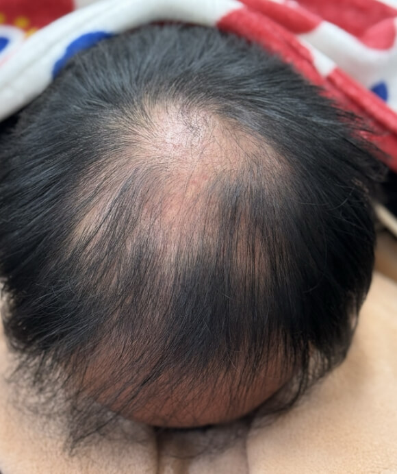 1年5ヶ月後
